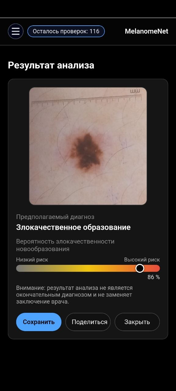 Экран результата анализа
